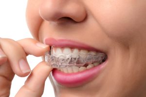 invisalign southlake