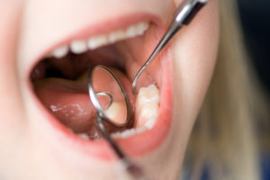 child's smile with dental tools