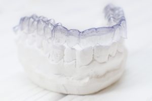 Invisalign aligner