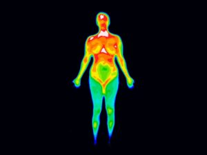 thermography