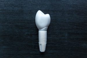 ceramic dental implant
