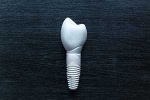 Zirconia, holistic dental implant in Southlake against dark background