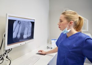 Dental team member reviewing X-ray on computer monitor