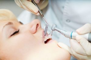 Dental hygienist polishing patient’s teeth