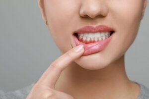 Woman pulling on her lower lip to reveal inflamed gums