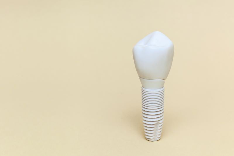 Zirconia Dental Implants A Safe and Form of Tooth